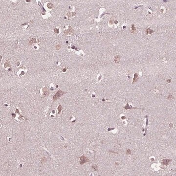 Anti-CPT1C antibody produced in rabbit Prestige Antibodies&#174; Powered by Atlas Antibodies, affinity isolated antibody