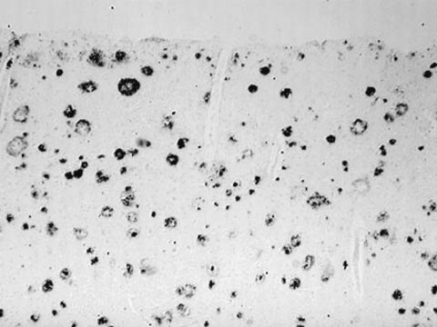 Anti-Amyloid Antibody, &#946; 37-42, a&#946; serum, Chemicon&#174;