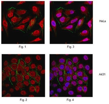 Anti-Ubiquitin K11 linkage Antibody, clone 2A3/2E6 clone 2A3/2E6, from rabbit