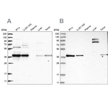 Anti-TBCC antibody produced in rabbit Prestige Antibodies&#174; Powered by Atlas Antibodies, affinity isolated antibody, buffered aqueous glycerol solution