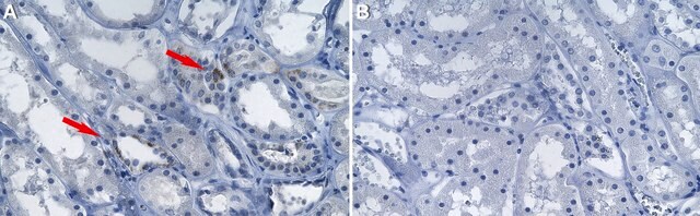 Anti-PNPLA3 Antibody, clone 11C5 ZooMAb&#174; Mouse Monoclonal recombinant, expressed in HEK 293 cells