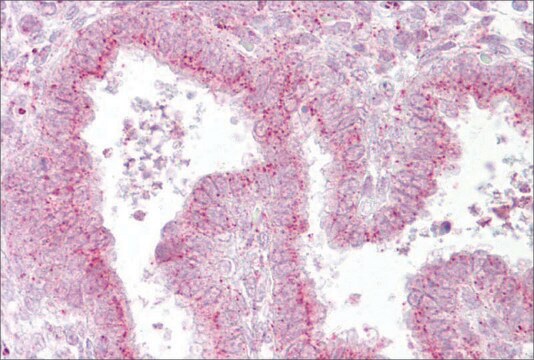 Anti-GOLGB1 antibody produced in rabbit affinity isolated antibody