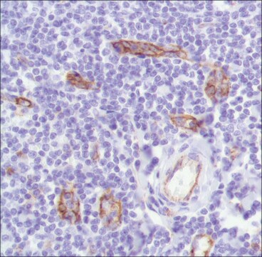 Anti-CD31 antibody, Rabbit monoclonal clone SP164, recombinant, expressed in proprietary host, affinity isolated antibody