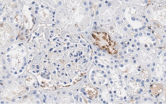 抗PEDF（SERPINF1）抗体 クローン2C16 ZooMAb&#174;ウサギモノクローナル recombinant, expressed in HEK 293 cells