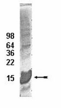 UbcH5c Conjugating Enzyme, 100 &#181;g The His6-tagged fusion protein of UbcH5c is charge &amp; support ubiquitinylation in vitro. The His6-tagged UbcH5 family members all appear to form thiol ester conjugates with ubiquitin at a similar rate under similar conditions.