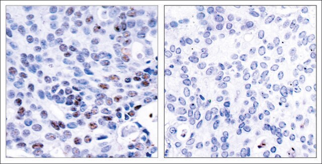 Anti-NFKB1 (Ab-337) antibody produced in rabbit affinity isolated antibody