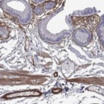 Anti-HSPG2 antibody produced in rabbit Prestige Antibodies&#174; Powered by Atlas Antibodies, affinity isolated antibody, buffered aqueous glycerol solution