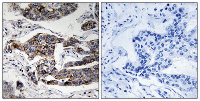 Anti-phospho-Girdin (pSer1417) antibody produced in rabbit affinity isolated antibody