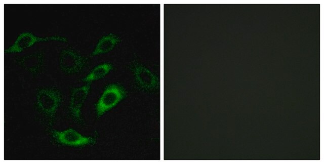 Anti-PTGDR antibody produced in rabbit affinity isolated antibody