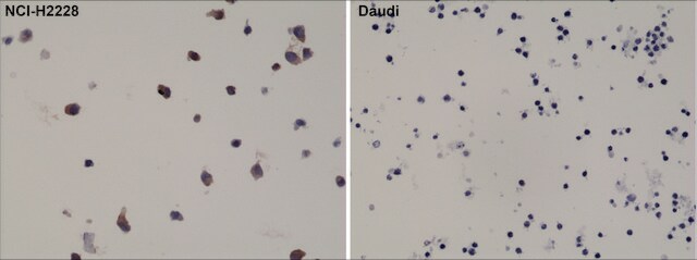 Anti-ALK antibody, Rabbit monoclonal recombinant, expressed in HEK 293 cells, clone RM361, purified immunoglobulin