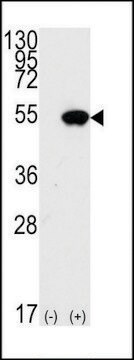 ANTI-P53 (S15) antibody produced in rabbit affinity isolated antibody, buffered aqueous solution