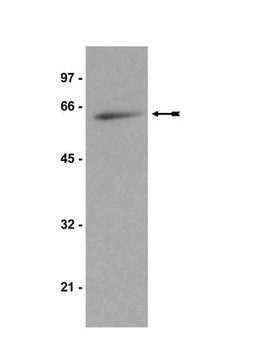 Anti-p70 S6 Kinase Antibody Upstate&#174;, from rabbit