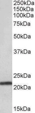 Anti-TMEM205 antibody produced in goat affinity isolated antibody, buffered aqueous solution