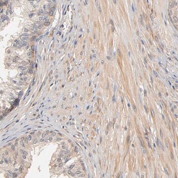 Anti-PDE5A antibody produced in rabbit Ab1, Prestige Antibodies&#174; Powered by Atlas Antibodies, affinity isolated antibody, buffered aqueous glycerol solution