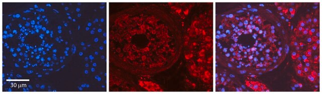 Anti-MYH1, (N-terminal) antibody produced in rabbit affinity isolated antibody