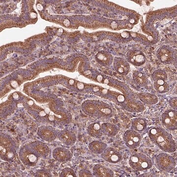 Anti-SLC25A5 antibody produced in rabbit Prestige Antibodies&#174; Powered by Atlas Antibodies, affinity isolated antibody