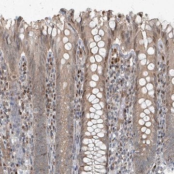 Anti-RHPN2 antibody produced in rabbit Prestige Antibodies&#174; Powered by Atlas Antibodies, affinity isolated antibody, buffered aqueous glycerol solution