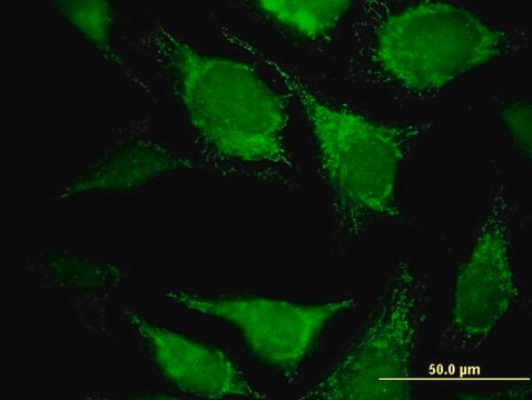 Monoclonal Anti-DECR2 antibody produced in mouse clone 4A7, purified immunoglobulin, buffered aqueous solution