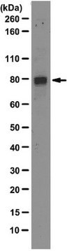 Anti-Mdmx Antibody, clone 8C6 clone 8C6, from mouse