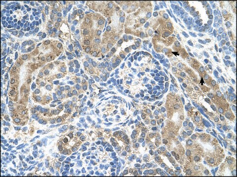 Anti-CRELD1 antibody produced in rabbit IgG fraction of antiserum