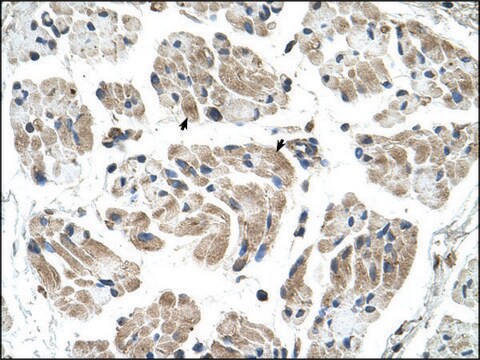 Anti-CHST1 antibody produced in rabbit IgG fraction of antiserum