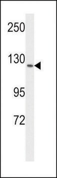 ANTI-VGFR1 antibody produced in rabbit purified immunoglobulin, buffered aqueous solution