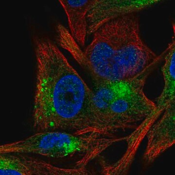 Anti-TYR antibody produced in rabbit Prestige Antibodies&#174; Powered by Atlas Antibodies, affinity isolated antibody