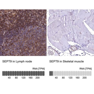 Anti-SEPT9 antibody produced in rabbit Prestige Antibodies&#174; Powered by Atlas Antibodies, affinity isolated antibody, buffered aqueous glycerol solution