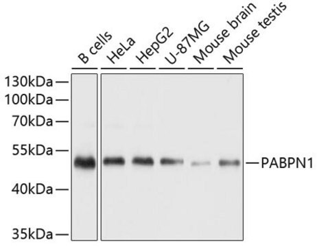 Anti-PABPN1 antibody produced in rabbit