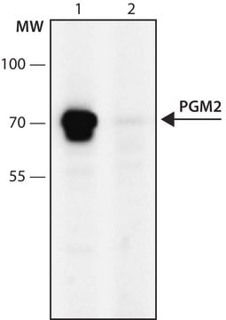 Anti-PGM2 (596-610) antibody produced in rabbit IgG fraction of antiserum