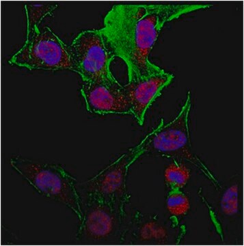 Anti-TLE1 Antibody from rabbit, purified by affinity chromatography