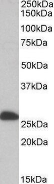 Anti-ETFB antibody produced in goat affinity isolated antibody, buffered aqueous solution