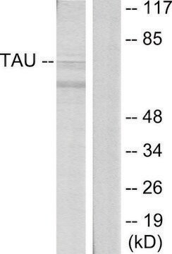 Anti-TAU antibody produced in rabbit affinity isolated antibody