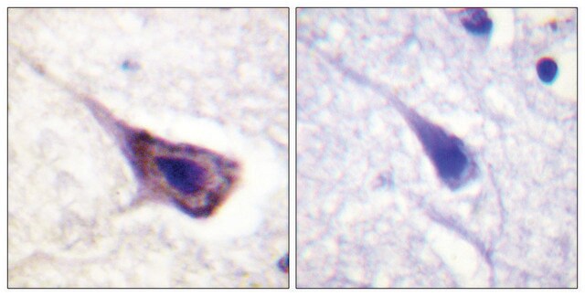 Anti-BAD antibody produced in rabbit affinity isolated antibody