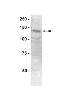 Anti-PTP&#945; Antibody Upstate&#174;, from rabbit