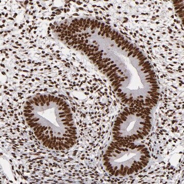 Anti-MRE11 antibody produced in rabbit Prestige Antibodies&#174; Powered by Atlas Antibodies, affinity isolated antibody, buffered aqueous glycerol solution