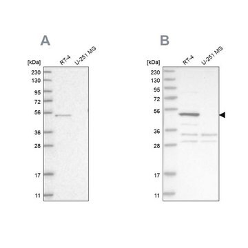 Anti-SCP2 antibody produced in rabbit Prestige Antibodies&#174; Powered by Atlas Antibodies, affinity isolated antibody, buffered aqueous glycerol solution