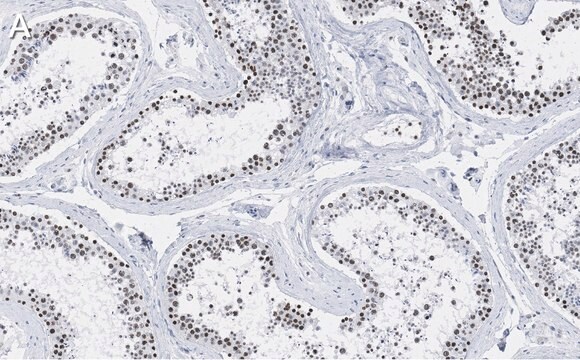 Anti-SUZ12 Antibody, clone 2E2 ZooMAb&#174; Rabbit Monoclonal recombinant, expressed in HEK 293 cells