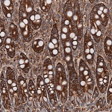 Anti-USP6NL antibody produced in rabbit Prestige Antibodies&#174; Powered by Atlas Antibodies, affinity isolated antibody, buffered aqueous glycerol solution