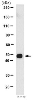 Anti-Tau, a.a. 210-241 Antibody, clone Tau-5 clone TAU-5, from mouse