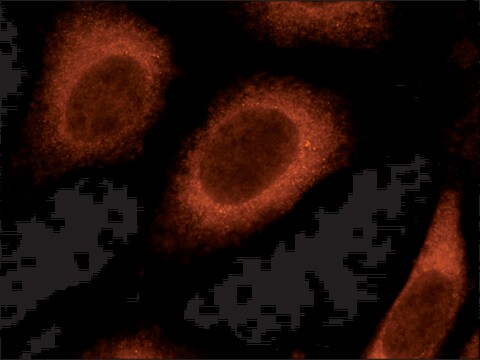 Anti-Rab8 antibody produced in rabbit IgG fraction of antiserum, buffered aqueous solution