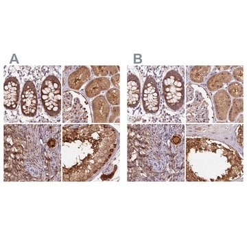 Anti-ST13 antibody produced in rabbit Prestige Antibodies&#174; Powered by Atlas Antibodies, affinity isolated antibody, buffered aqueous glycerol solution