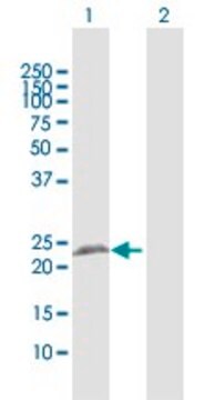 Anti-RTN3 antibody produced in rabbit purified immunoglobulin, buffered aqueous solution