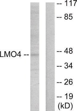 Anti-LMO4 antibody produced in rabbit affinity isolated antibody