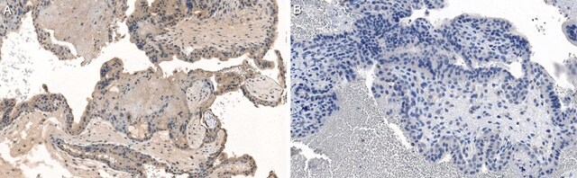 Anti-PDGF-BB Antibody, clone 6A9.9.11