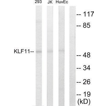 Anti-KLF11 antibody produced in rabbit affinity isolated antibody