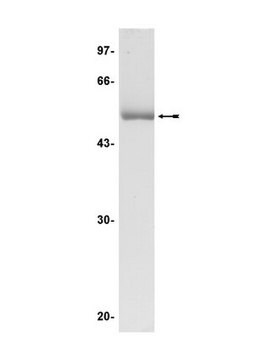 JNK2&#945;2/SAPK1a Protein, inactive, 50 g Unactive, N-terminal His6-tagged, recombinant, full-length, human JNK2&#945;2/SAPK1a unactive, for use in Kinase Assays.