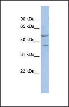 Anti-NKX6-1, (N-terminal) antibody produced in rabbit affinity isolated antibody