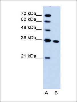 Anti-SLC25A29 antibody produced in rabbit IgG fraction of antiserum