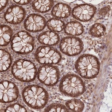 Anti-R3HDM2 antibody produced in rabbit Prestige Antibodies&#174; Powered by Atlas Antibodies, affinity isolated antibody, buffered aqueous glycerol solution